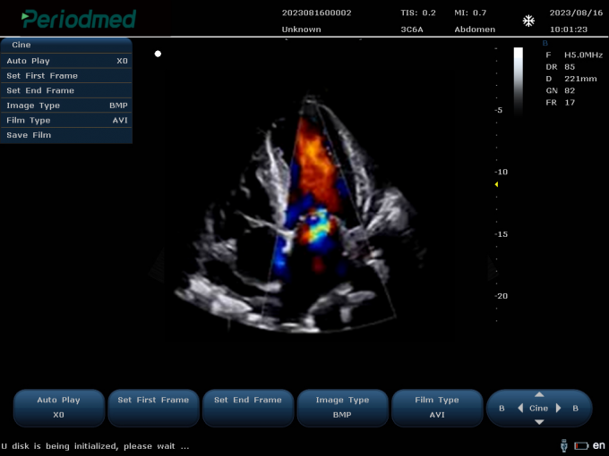 ç¸æ§éµæ¢å¤´-å½©è²å¤æ®åæ¨¡å¼-å¿è Phased Array Probe-Color Mode-Cardiac2